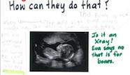 Worksheet showing baby ultrasound